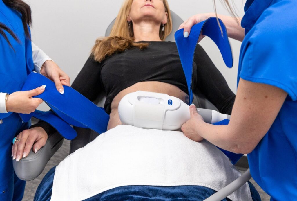 CoolSculpting