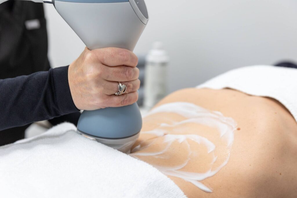 Non-Surgical Body Sculpting